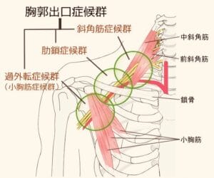 alt="原因不明の首こりや肩こりに関係する胸郭周辺の神経と血管の解剖学イメージ図"