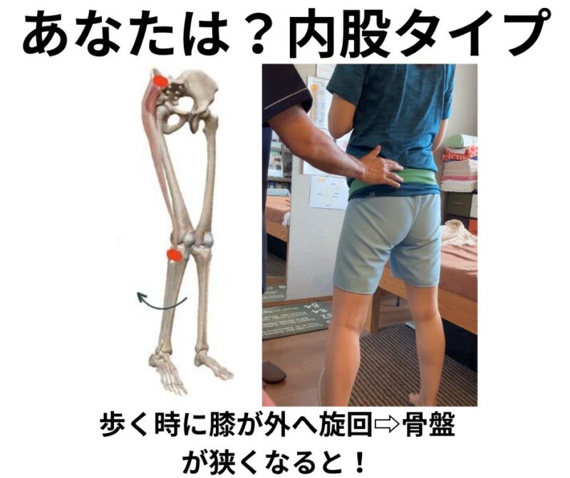 骨盤前傾時の股関節の動きと太ももの張りのイメージ図