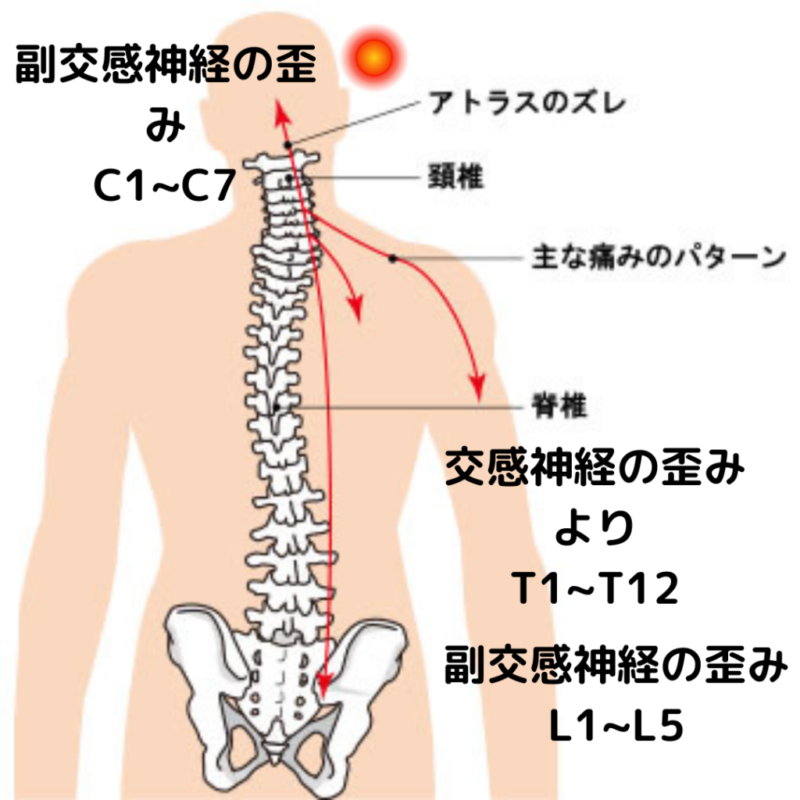 Parasympathetic-headache