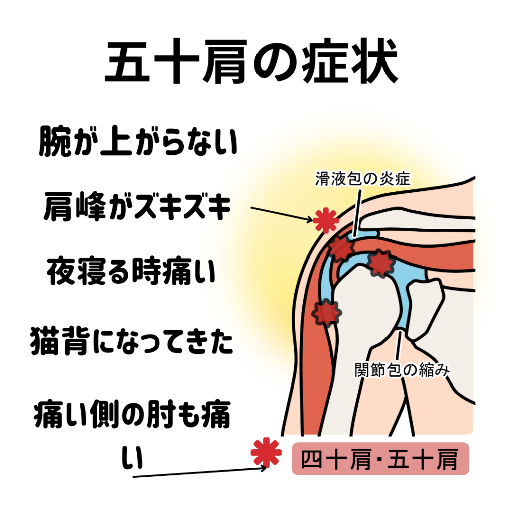 frozen-shoulder-pain