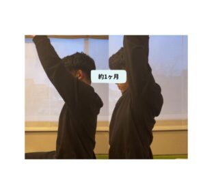 ズキズキする肩の痛みがなくなった感覚の個人の表情です