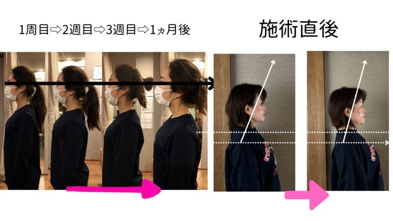 姿勢改善