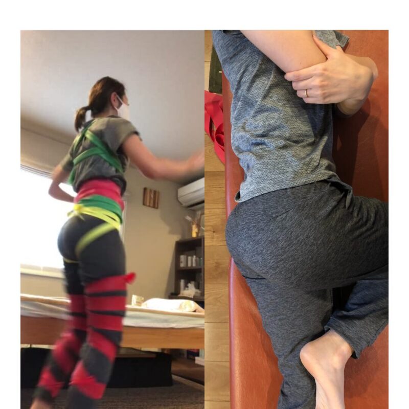 骨盤矯正後の下半身ラインの変化イメージ