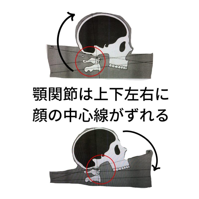 Balance between the temporomandibular -joint-and-the-cognate- bone