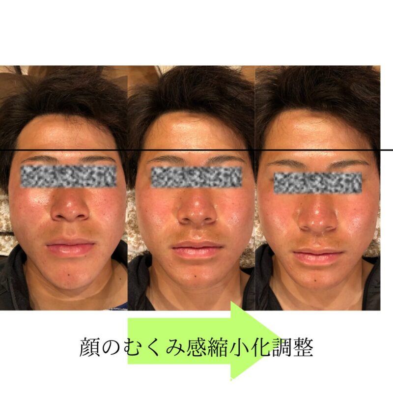 Small-face-before-and-after