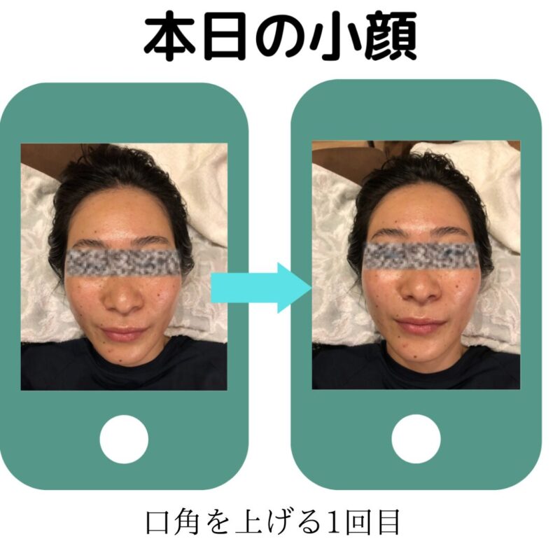 Small-face-before-and-after