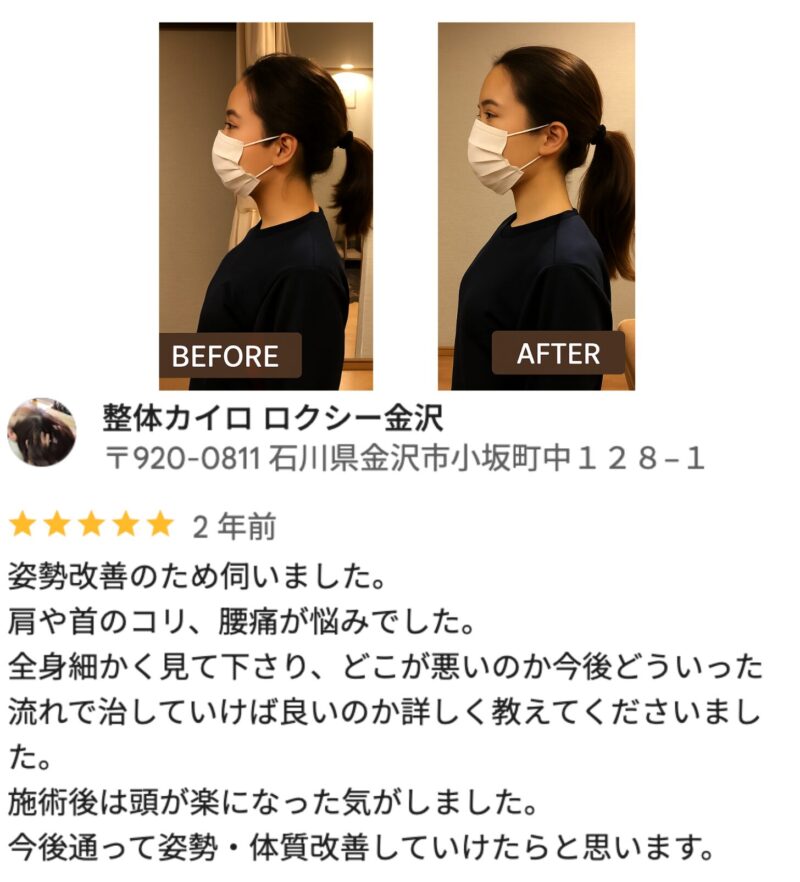 首のストレートネックと姿勢ケアで変化を感じた30代女性N様の口コミ