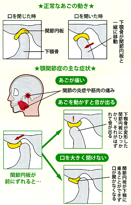 Normal-Jaw-Anatomy