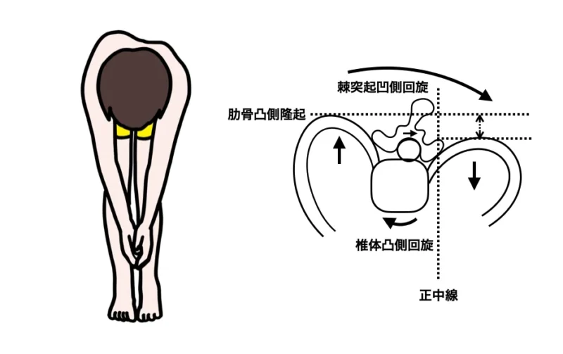 Special-mention-of-spine-song-uneven-side-line