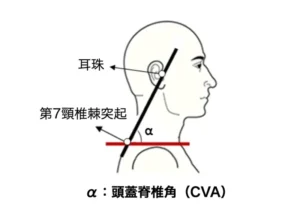 skull-pinal-angle