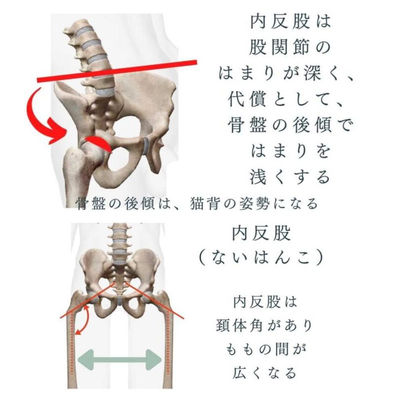 Since the hip joint varus is tightly fitted, the-pelvis-must-be -tilted-backwards-in- order-to-rotate.
