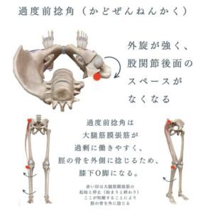 内股タイプと膝下の動きのイメージ