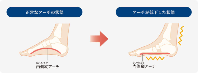 冷え性改善のための血行を良くする足底のアーチ作りのイメージ図