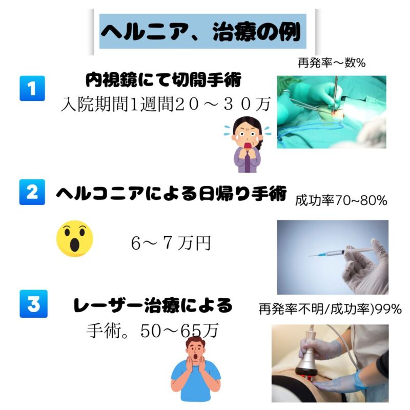 現代医療事例のヘルニア治療法の価格