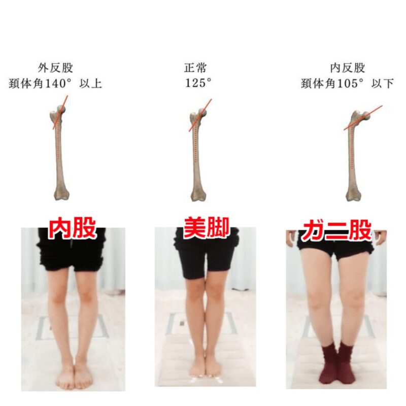 Types-of-hip-joints