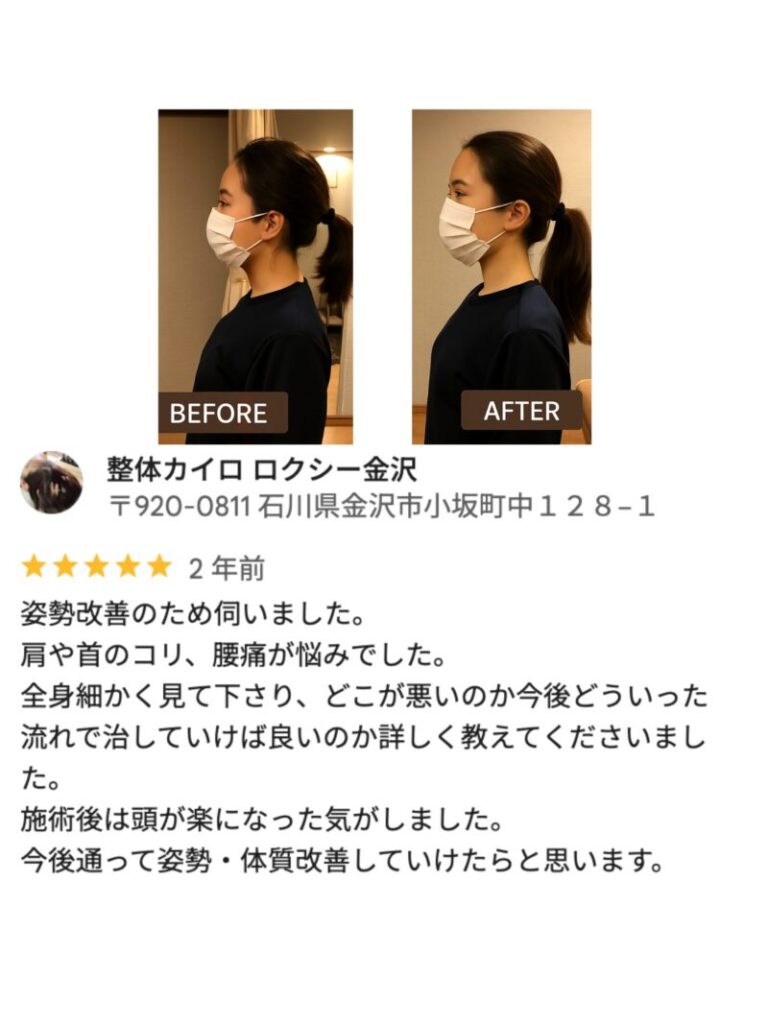 首のストレートネックと姿勢ケアで変化を感じた30代女性N様の口コミ