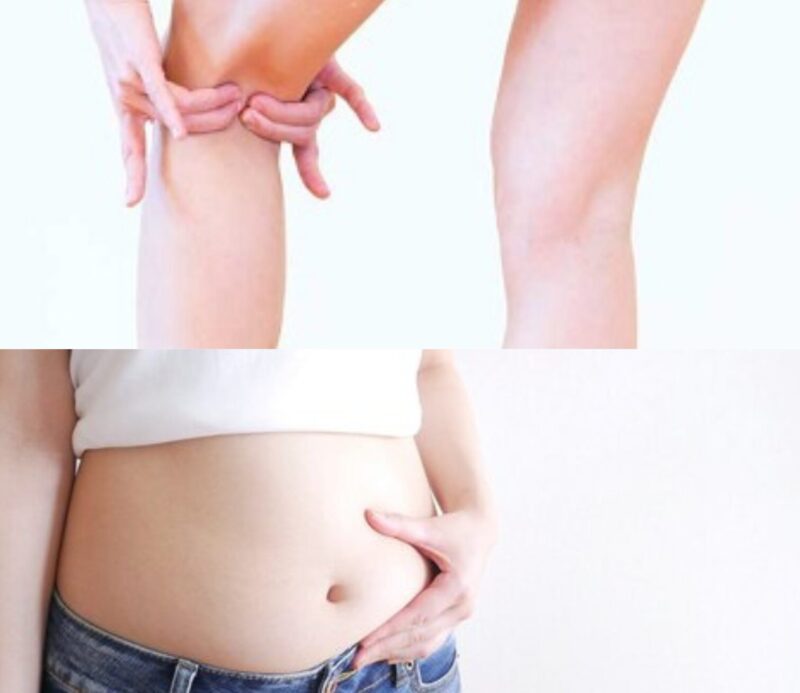 太ももや膝裏のリンぱむくみ、ぽっこりお腹