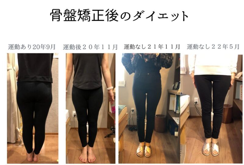 整体カイロロクシー金沢での骨盤矯正後のダイエットの経過