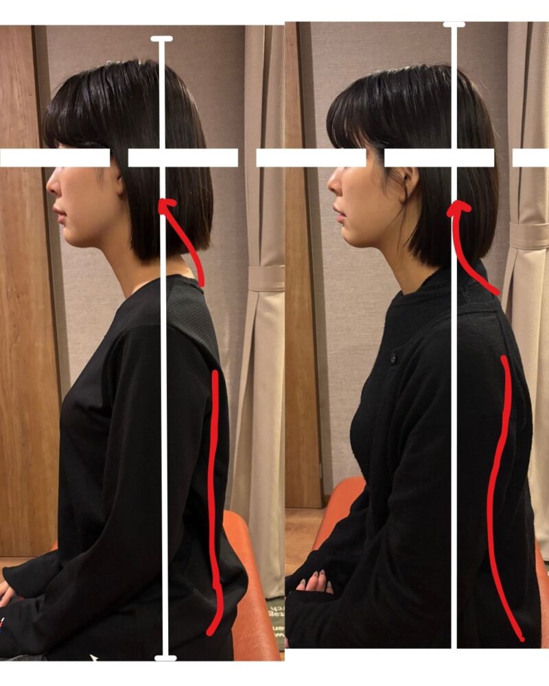 首から変わる姿勢改善