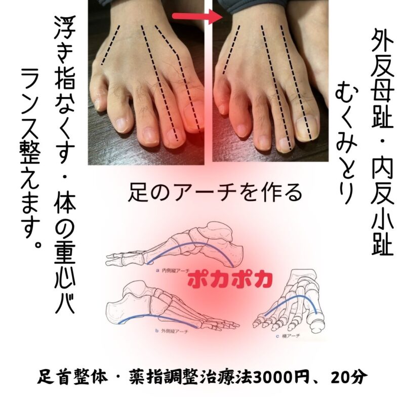 立方骨のロック