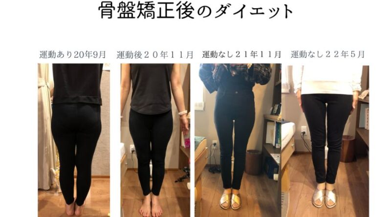 骨盤矯正後のダイエットの経過